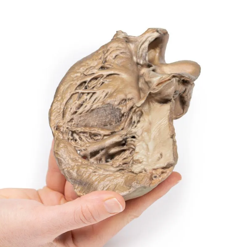 3D Printed Biscupid Aortic Valve